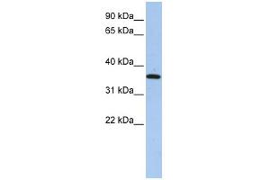 WB Suggested Anti-FAM84A Antibody Titration: 0. (FAM84A anticorps  (N-Term))