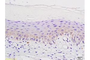 Formalin-fixed and paraffin embedded mouse skin labeled with Anti-°-Opioid receptor Polyclonal Antibody, Unconjugated (ABIN701755) followed by conjugation to the secondary antibody and DAB staining