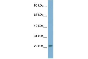 WB Suggested Anti-MFAP2 Antibody Titration: 0. (MFAP2 anticorps  (N-Term))