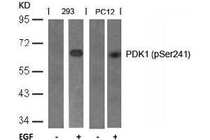 Image no. 2 for anti-3-phosphoinositide Dependent Protein Kinase-1 (PDPK1) (pSer241) antibody (ABIN196616) (PDPK1 anticorps  (pSer241))