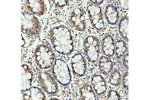 IHC analysis of Prohibitin/PHB using anti-Prohibitin/PHB antibody (ABIN7599170). (Prohibitin anticorps  (AA 1-257))
