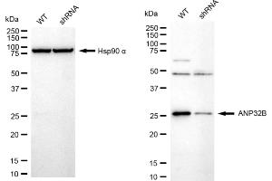 Western blotting analysis using ANP32B antibody (ABIN7797448).
