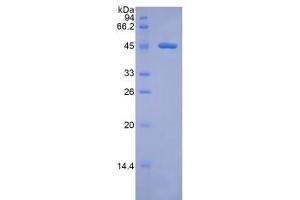 SDS-PAGE of Protein Standard from the Kit (Highly purified E. (Factor VII Kit ELISA)