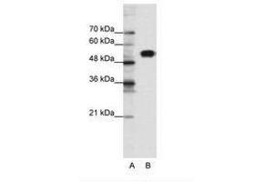 Image no. 1 for anti-Chloride Channel Kb (CLCNKB) (N-Term) antibody (ABIN6735463)