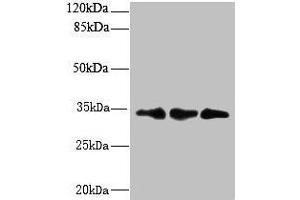 Western blot All lanes: CNOT9 antibody at 6 μg/mL Lane 1: HepG2 whole cell lysate Lane 2: Mouse small intestine tissue Lane 3: Mouse spleen tissue Secondary Goat polyclonal to rabbit IgG at 1/10000 dilution Predicted band size: 34, 37, 30 kDa Observed band size: 34 kDa (RQCD1 anticorps  (AA 1-258))