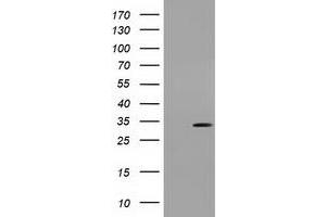 Western Blotting (WB) image for anti-Uridine-Cytidine Kinase 1 (UCK1) antibody (ABIN1501666)