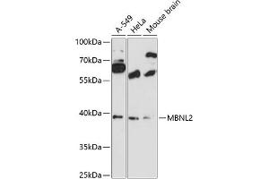 Western blot analysis of extracts of various cell lines, using MBNL2 antibody (ABIN6132336, ABIN6143603, ABIN6143604 and ABIN6216609) at 1:3000 dilution. (MBNL2 anticorps  (AA 160-260))