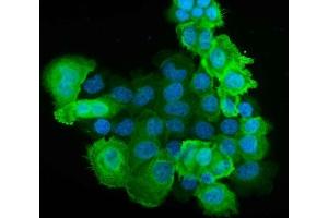 IF analysis of S100A6 using anti-S100A6 antibody (ABIN3043321).