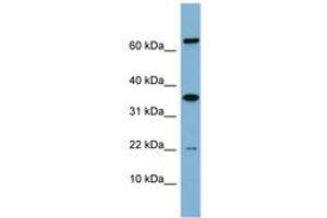 Image no. 1 for anti-RWD Domain Containing 1 (RWDD1) (AA 71-120) antibody (ABIN6741945) (RWDD1 anticorps  (AA 71-120))