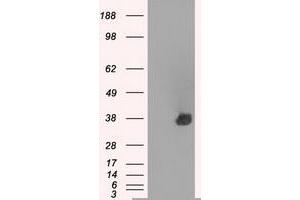 Western Blotting (WB) image for anti-Aurora Kinase C (AURKC) antibody (ABIN1496783)