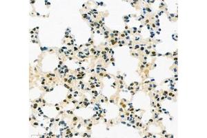 Immunohistochemistry of paraffin embedded mouse lung using TEAD3 (ABIN7075852) at dilution of 1: 700 (400x lens)