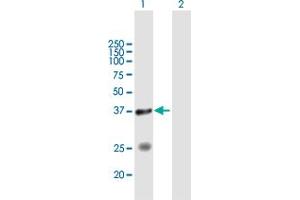 Western Blot analysis of STYXL1 expression in transfected 293T cell line by STYXL1 MaxPab polyclonal antibody. (STYXL1 anticorps  (AA 1-313))