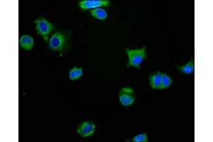 Immunofluorescence staining of MCF-7 cells with ABIN7160445 at 1:200, counter-stained with DAPI.