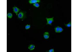 Immunofluorescence staining of MCF-7 cells with ABIN7160445 at 1:200, counter-stained with DAPI. (MAG anticorps  (AA 25-516))