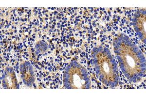 Detection of BCL2L11 in Human Appendix Tissue using Polyclonal Antibody to Bcl2 Like Protein 11 (BCL2L11)