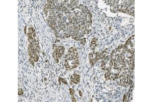 IHC analysis of PARP using anti-PARP antibody (ABIN7602278). (PARP1 anticorps  (AA 670-858))