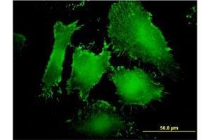 Immunofluorescence of monoclonal antibody to MAGI1 on HeLa cell.