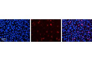 NR2F6 antibody - N-terminal region          Formalin Fixed Paraffin Embedded Tissue:  Human Liver Tissue    Observed Staining:  Nucleus in hepatocytes   Primary Antibody Concentration:  1:100    Secondary Antibody:  Donkey anti-Rabbit-Cy3    Secondary Antibody Concentration:  1:200    Magnification:  20X    Exposure Time:  0. (NR2F6 anticorps  (N-Term))