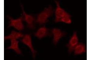 ABIN6276100 staining Hela by IF/ICC. (OR6C70 anticorps  (C-Term))