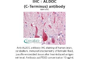 Image no. 1 for anti-Aldolase C, Fructose-Bisphosphate (ALDOC) (C-Term) antibody (ABIN2852410) (ALDOC anticorps  (C-Term))
