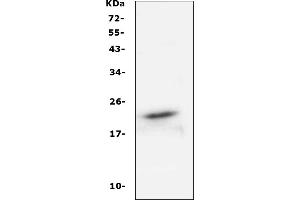 Western blot analysis of FGF21 using anti-FGF21 antibody (ABIN4886586).