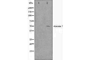 Western blot analysis on HepG2 cell lysate using Keratin 7 Antibody