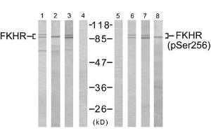 Western blot analysis using FKHR (Ab-256) antibody (E021138, Lane 1, 2, 3 and 4) and FKHR (phospho- Ser256)antibody (E011115, Lane 5, 6, 7 and 8). (FOXO1 anticorps  (pSer256))