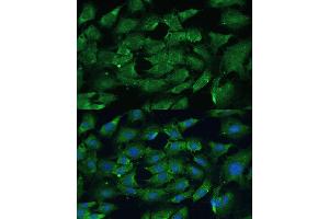 Immunofluorescence analysis of C6 cells using SHP2 antibody (ABIN6131893, ABIN6146440, ABIN6146441 and ABIN7101402) at dilution of 1:100.