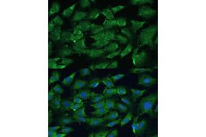 Immunofluorescence analysis of C6 cells using SHP2 antibody (ABIN6131893, ABIN6146440, ABIN6146441 and ABIN7101402) at dilution of 1:100. (PTPN11 anticorps  (AA 1-460))