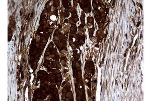 Image no. 11 for anti-Non-Metastatic Cells 1, Protein (NM23A) Expressed in (NME1) antibody (ABIN1499754)