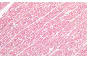 Detection of MYH1 in Human Heart Tissue using Polyclonal Antibody to Myosin Heavy Chain 1 (MYH1)