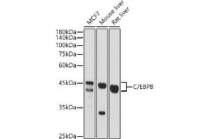 Western blot analysis of extracts of various cell lines, using C/EBPB antibody (ABIN6134025, ABIN6138382, ABIN6138383 and ABIN6213964) at 1:500 dilution. (CEBPB anticorps  (AA 150-250))