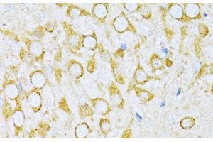 Immunohistochemistry of paraffin-embedded Rat brain using VARS Polyclonal Antibody at dilution of 1:100 (40x lens).