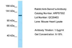 Western Blotting (WB) image for anti-DENN/MADD Domain Containing 1A (DENND1A) (C-Term) antibody (ABIN2787247) (DENND1A anticorps  (C-Term))