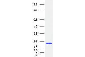 Validation with Western Blot