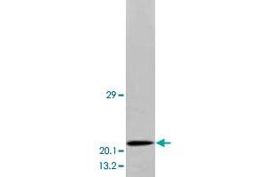 Western blot analysis of human brain tissue extracts with BDNF polyclonal antibody . (BDNF anticorps  (Middle Region))
