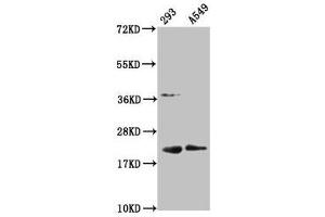 Western Blot Positive WB detected in: 293 whole cell lysate, A549 whole cell lysate All lanes: HIST1H1C antibody at 1:100 Secondary Goat polyclonal to rabbit IgG at 1/50000 dilution Predicted band size: 22 kDa Observed band size: 22 kDa