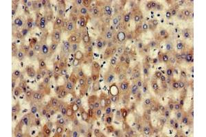 Immunohistochemistry of paraffin-embedded human liver tissue using ABIN7157444 at dilution of 1:100 (Cytokeratin 7 anticorps  (AA 2-469))