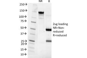 SDS-PAGE Analysis Purified Cytokeratin 8 Mouse Monoclonal Antibody (SPM538). (KRT8 anticorps)