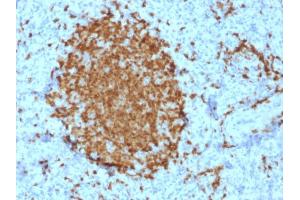 Formalin-fixed, paraffin-embedded human Spleen stained with BOB1 Mouse Monoclonal Antibody (BOB1/2421). (POU2AF1 anticorps  (AA 148-255))