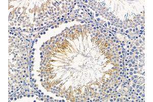 ABIN6264094 and ABIN6279286 at 1/100 staining rat testis tissue by IHC-P.