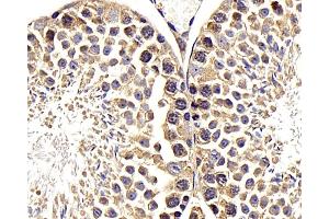 Immunohistochemistry analysis of paraffin-embedded mouse testis using RACGAP1 Polyclonal Antibody at dilution of 1:400. (RACGAP1 anticorps)
