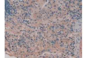IHC-P analysis of Rat Spleen Tissue, with DAB staining. (TNFRSF1B anticorps  (AA 25-229))