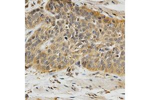 Immunohistochemistry (IHC) image for anti-Polo-Like Kinase 1 (PLK1) (AA 304-603) antibody (ABIN3023352) (PLK1 anticorps  (AA 304-603))