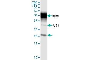 Immunoprecipitation of TMEM126B transfected lysate using anti-TMEM126B MaxPab rabbit polyclonal antibody and Protein A Magnetic Bead , and immunoblotted with TMEM126B MaxPab rabbit polyclonal antibody (D01) . (TMEM126B anticorps  (AA 1-200))