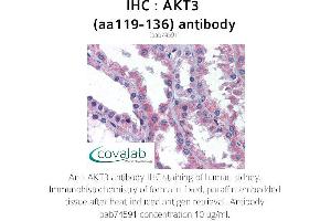 Image no. 2 for anti-V-Akt Murine Thymoma Viral Oncogene Homolog 3 (Protein Kinase B, Gamma) (AKT3) (AA 119-136) antibody (ABIN1731657) (AKT3 anticorps  (AA 119-136))
