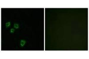 Immunofluorescence analysis of HepG2 cells, using MUC16 antibody. (MUC16 anticorps)