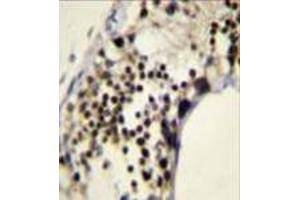 Formalin fixed, paraffin embedded human testis tissue stained with RACGAP1 Antibody (N-term) followed by peroxidase conjugation of the secondary antibody and DAB staining.