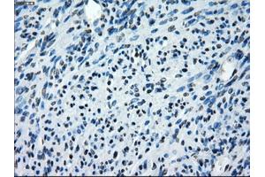 Immunohistochemistry (IHC) image for anti-SATB Homeobox 1 (SATB1) antibody (ABIN1500810)
