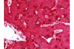 Anti-DDH / AKR1C1 antibody IHC staining of human liver. (AKR1C1 anticorps  (AA 22-248))